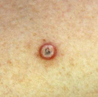 Gezondheidsplein.nl | Alles over gezondheid binnen handbereik