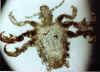 Pediculus pubis